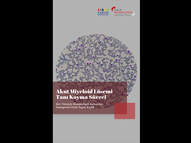 Akut Miyeloid Lösemide Tanı Koyma Süreci