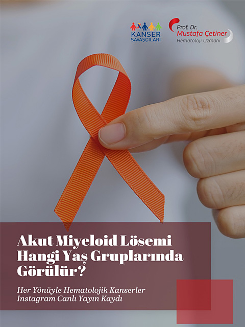 Akut Miyeloid Lösemi Genellikle Yetişkin Bireylerde Ortaya Çıkar