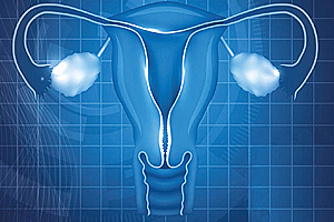 Endometriyal Kanser